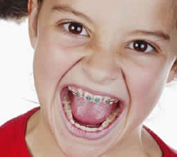 Orthodontie kosten